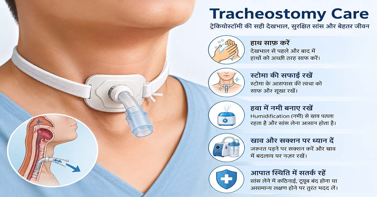 Tracheostomy tube और stoma की देखभाल